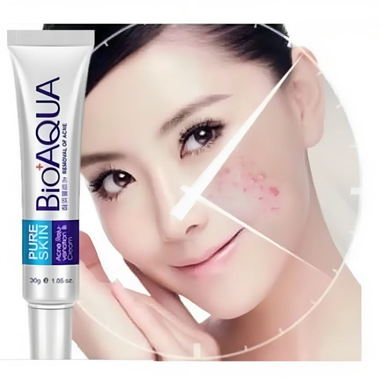 BIOAQUA Pure Skin Acne Removal & Anti-Wrinkle Cream